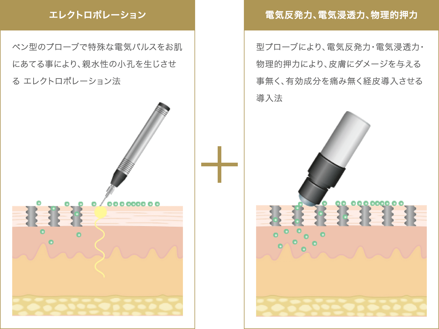 メソポレーションの仕組み